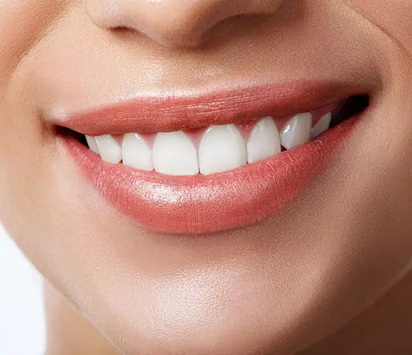 Dental Aesthetics