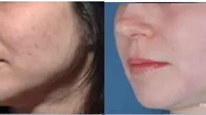 Get your skin glowing with our A-list treatment!