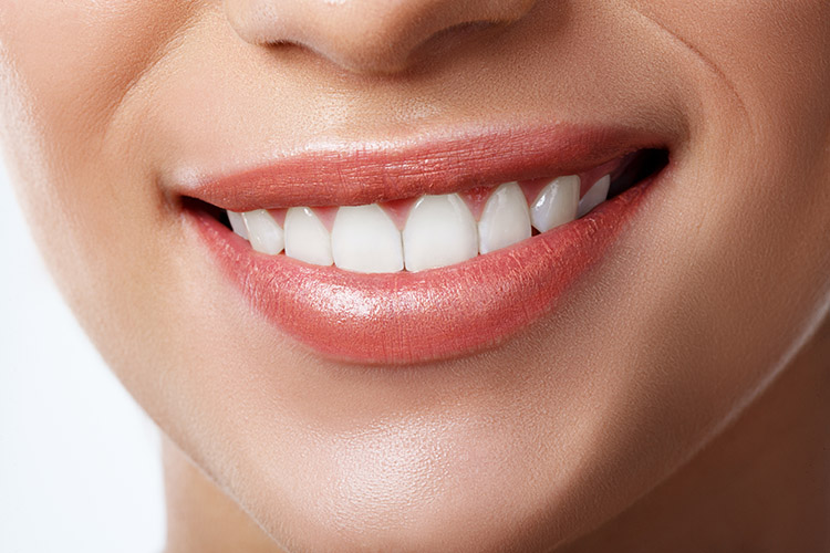 Dental Aesthetics